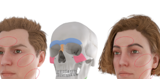 Bài viết chuyên sâu: Phẫu thuật chuyển giới